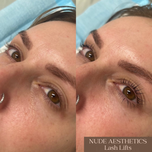 Lash lift