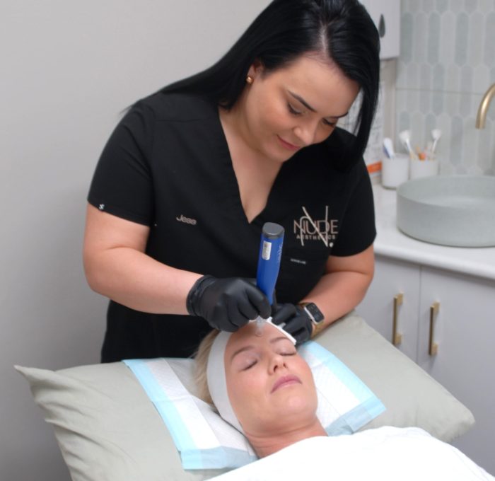 skin needling